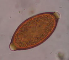 Microscope view of a barrel-shaped whipworm egg with clear rounded caps