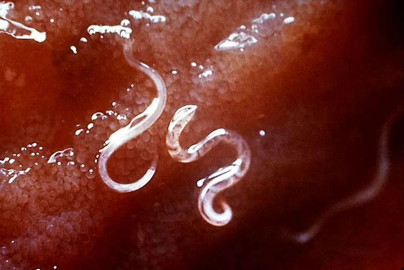 Close-up of thin white hookworms with hooked ends on reddish intestinal tissue